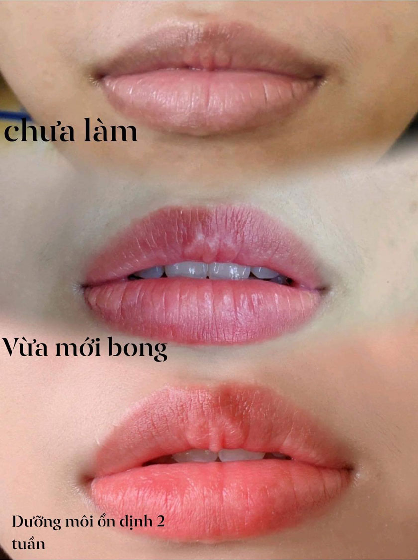 Phun môi không lên màu hoa bé